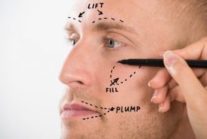 mens dermal fillers