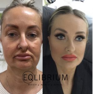 facial transformation Weybridge