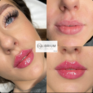 Russian lips weybridge