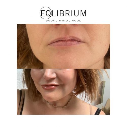natural lips Weybridge