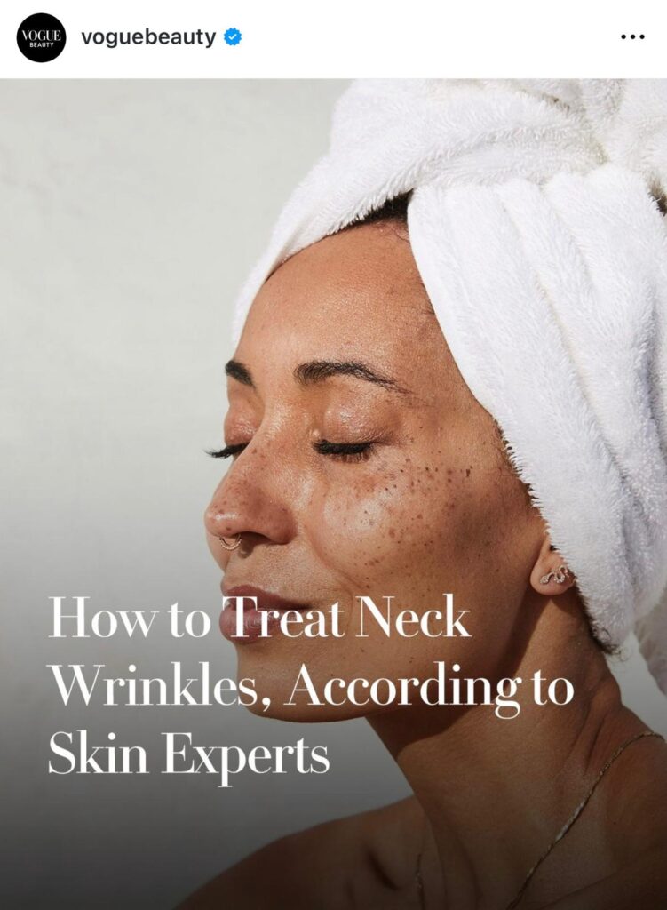 Treatment for Neck Wrinkles