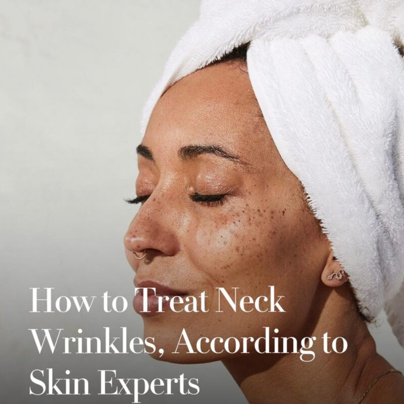 Treatment for Neck Wrinkles