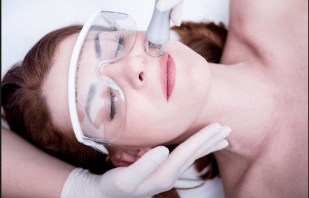 co2 laser vs microneedling london skin treatment